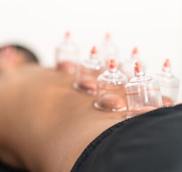 Cupping Massage